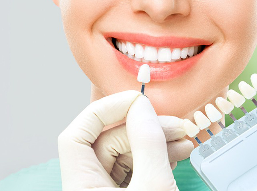 teeth whitening puchong